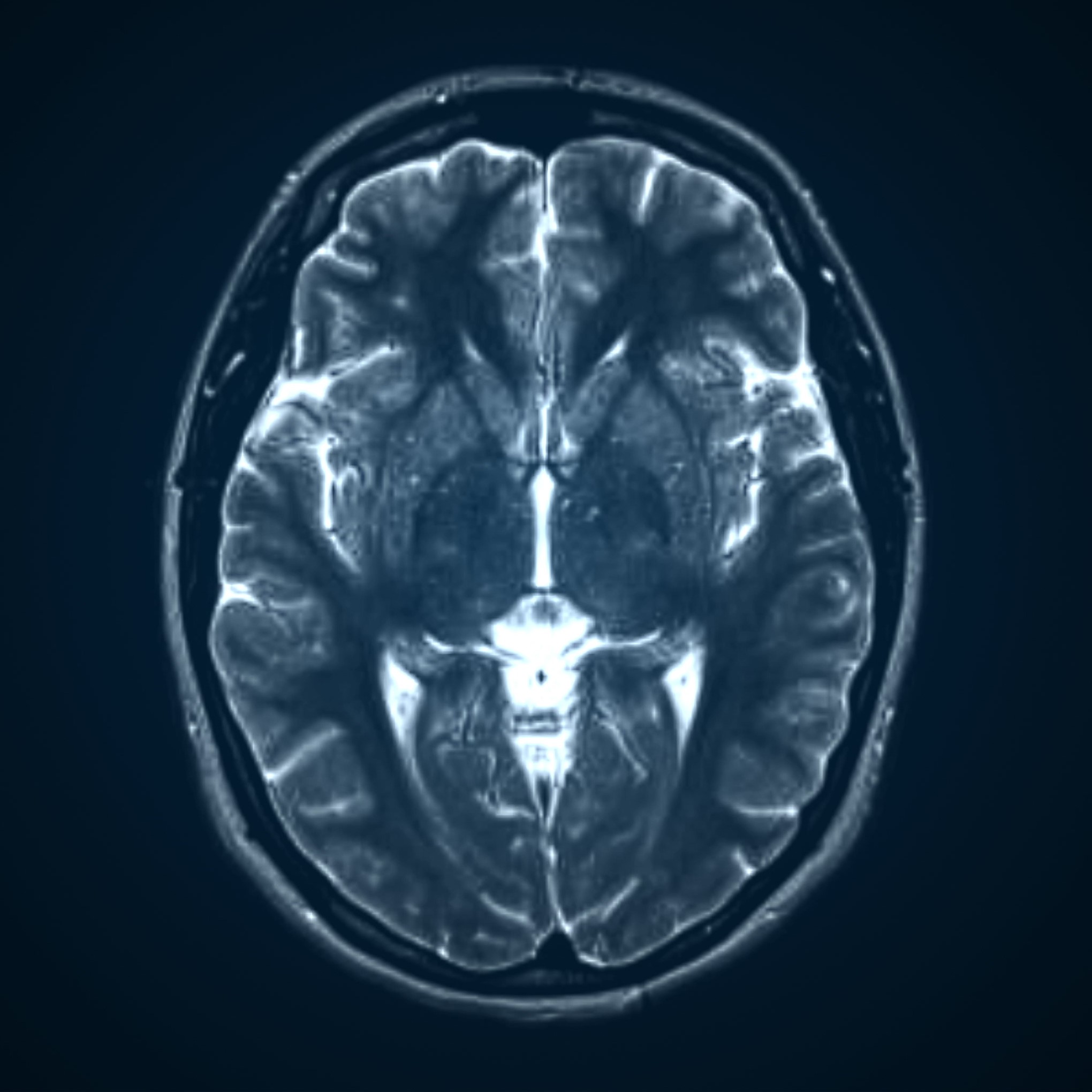 Brain imaging research